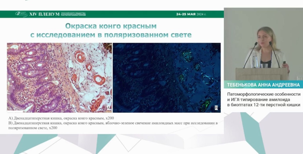 Тебенькова А.А. врач-патологоанатом лаборатории Де Жени, с докладом на XIV Пленуме РОП